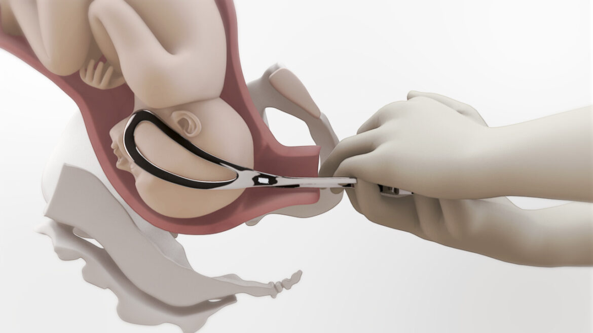 violencia obstétrica